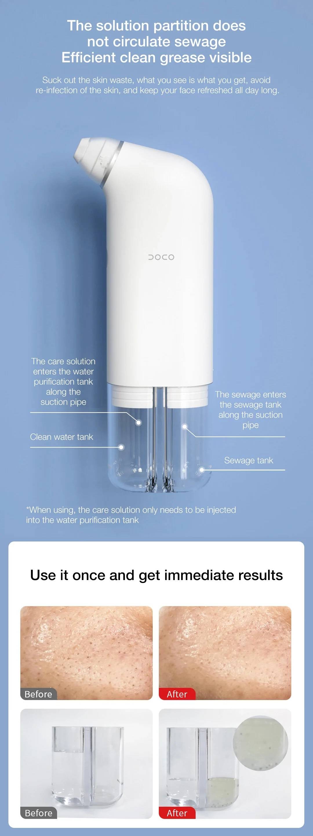Xiaomi DOCO Ultra-Micro Bubble Pore Vacuum Blackhead Remover