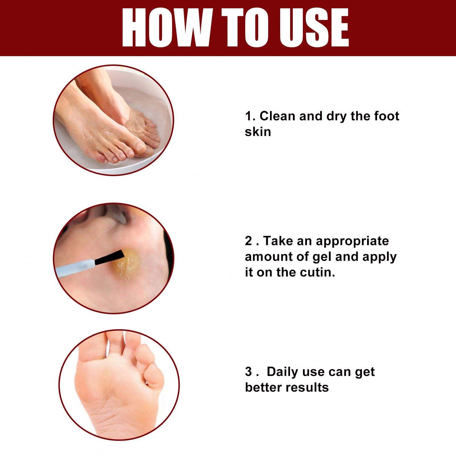 Foot Corn Removal