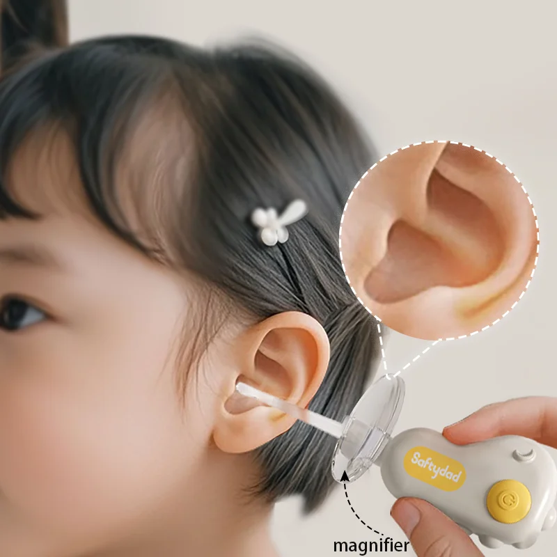 Smart LED Baby Ear Cleaner. বাচ্চার কান পরিষ্কার কতুন সফলি 
