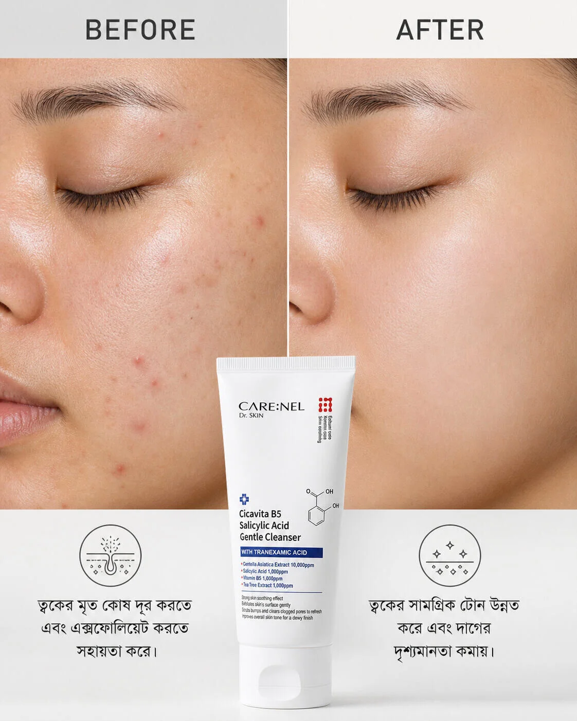 Nel Cicavita B5 Salicylic Acid Gentle Cleanser 150ml