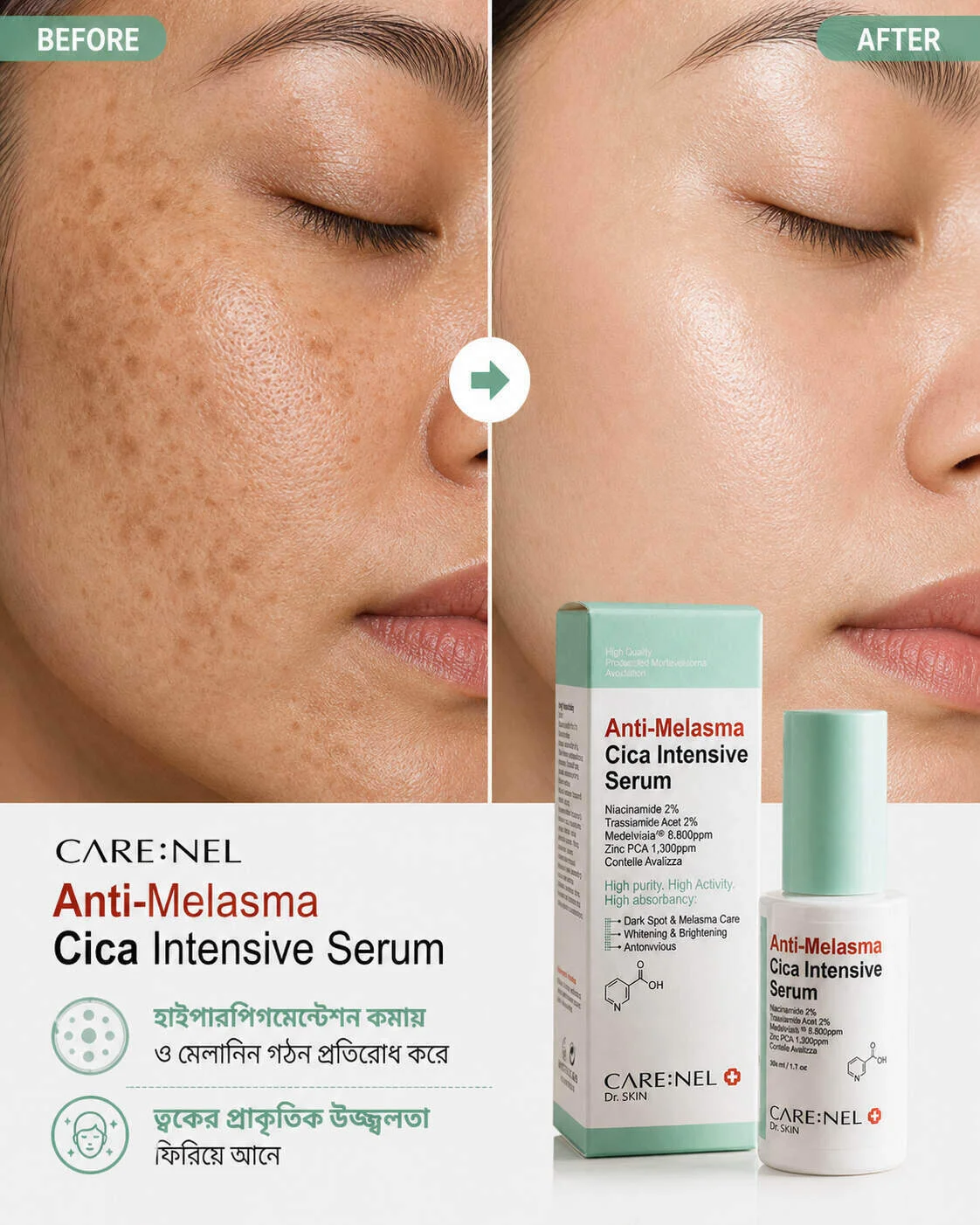 CARENEL Anti-Melasma Cica Intensive Serum 30ml CARENEL Anti-Melasma Cica Intensive Serum 30ml