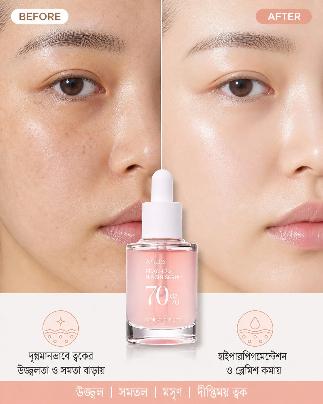 Anua Peach 70% Niacinamide Serum 30ml Anua Peach 70% Niacinamide Serum 30ml