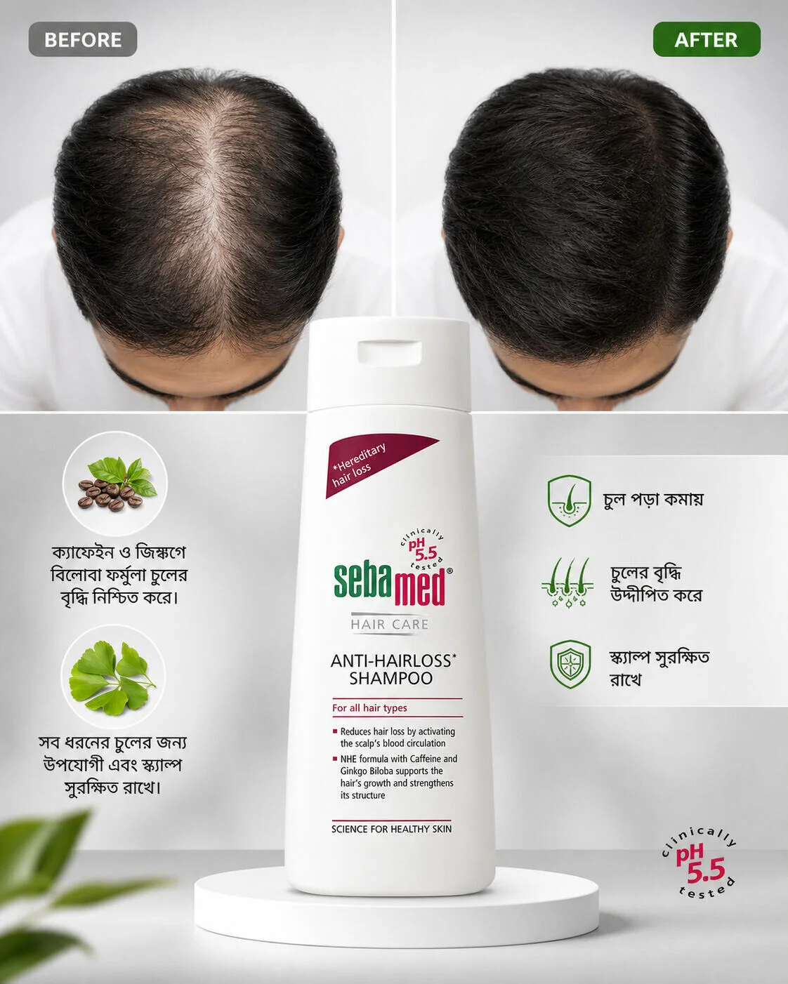 Sebamed Anti Hairloss Shampoo Reduces Hair Loss For All Hair Types 200ml Sebamed Anti Hairloss Shampoo Reduces Hair Loss For All Hair Types 200ml