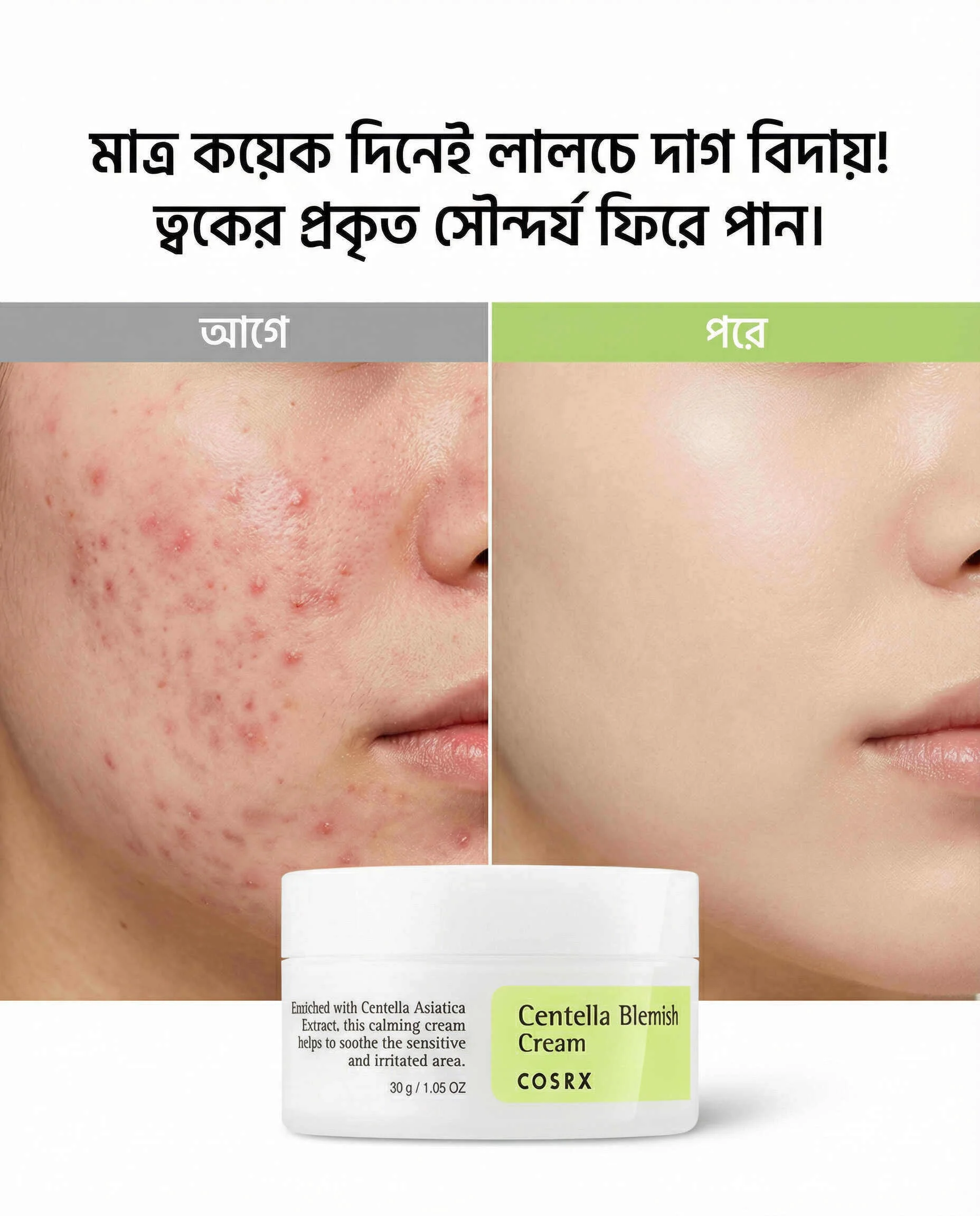 COSRX Centella Blemish Cream (30g) COSRX Centella Blemish Cream (30g)