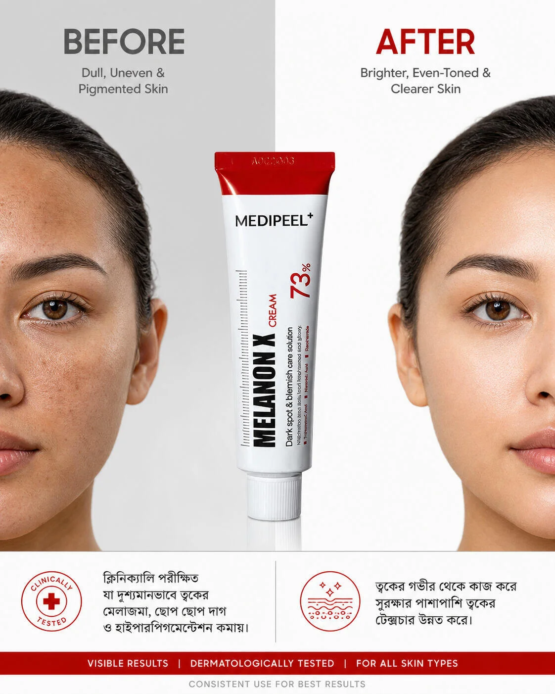 Medi-Peel Melanon X Cream 30ml