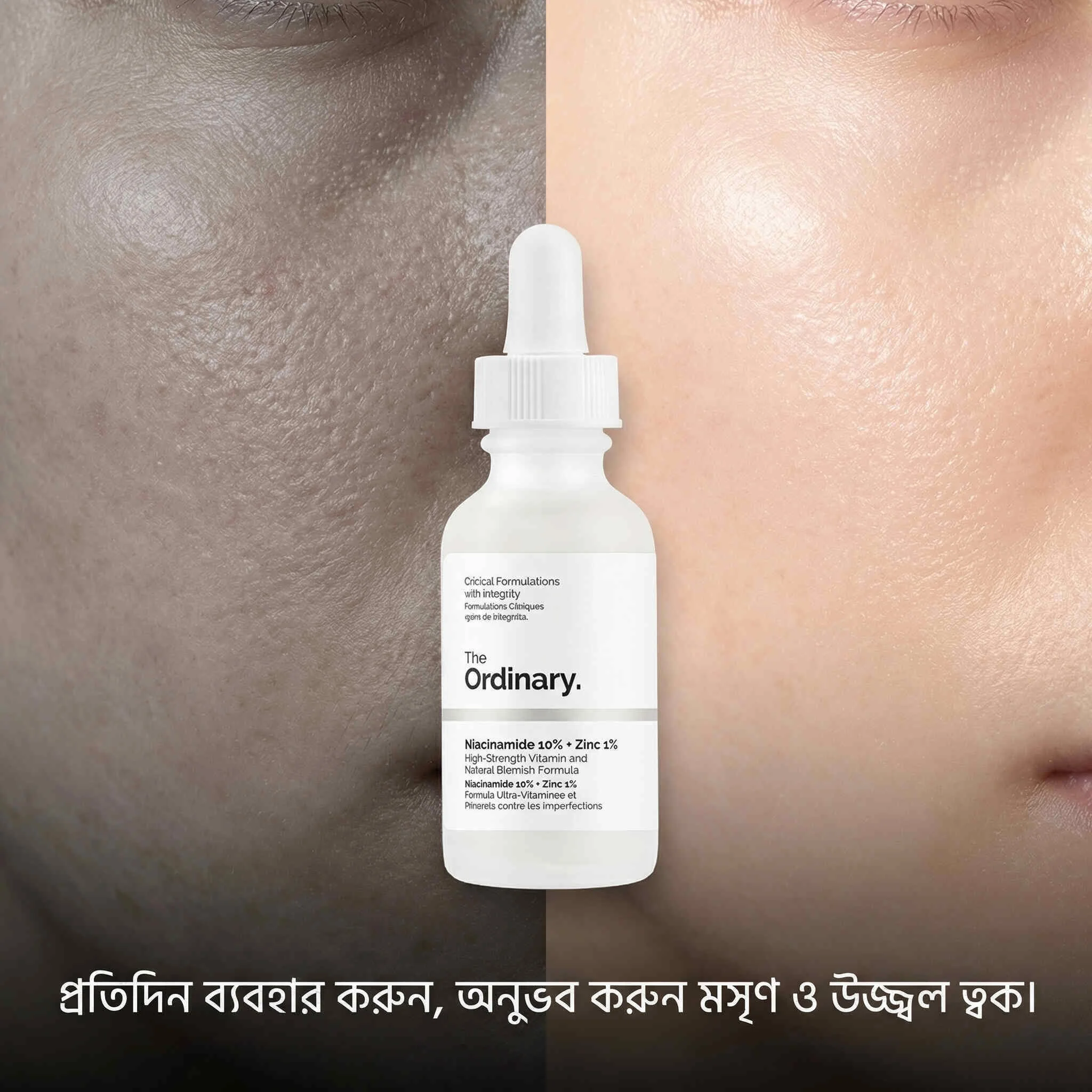 The Ordinary Niacinamide 10% + Zinc 1%